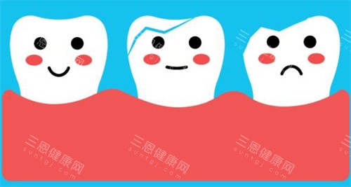 牙齿萌萌图 牙齿萌萌图