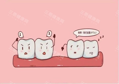 牙齿丢失漫画示意图 牙齿丢失漫画示意图