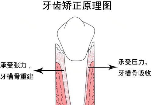 深圳光明麥芽口腔牙齒矯正醫生推薦:李君!6號線光明站直達,矯正方案細心講,環境舒適唔局促,粵語交流好親切～