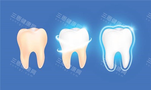 牙齿清洗后变白 牙齿清洗后变白