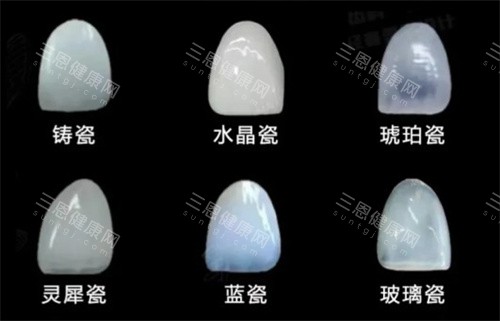 牙贴面材料