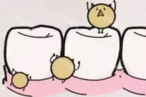 牙齿有细菌卡通图 牙齿有细菌卡通图