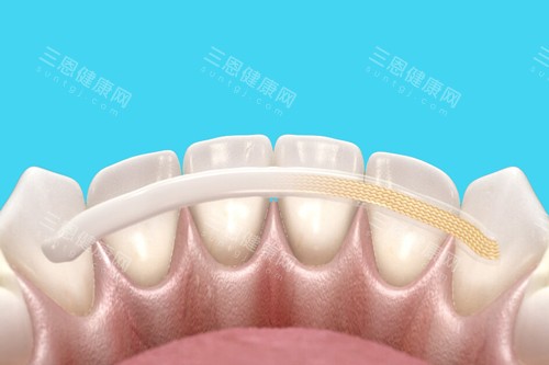 牙齿固定卡通图