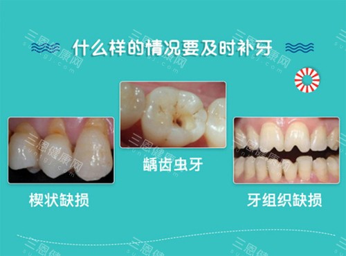 补牙适应症
