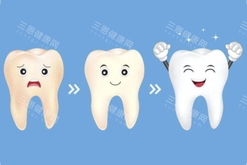 牙齿美白顺序图