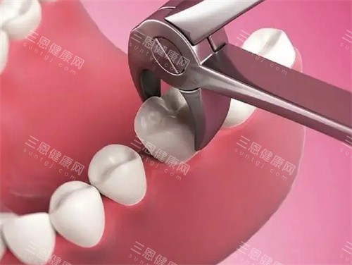 拔牙动画图 拔牙动画图