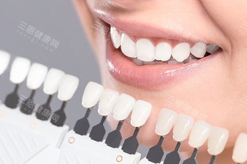 牙齿贴面色卡对比 牙齿贴面色卡对比