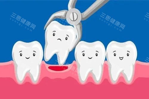 牙齿拔除卡通示意图 牙齿拔除卡通示意图