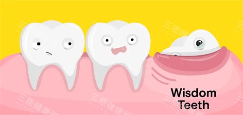 深圳拔智慧齒邊度好，香港人鍾意去深圳呢幾間牙科拔牙！