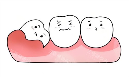 智齿卡通图片