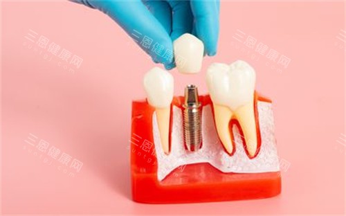 深圳鵬程口腔點樣？正規唔正規？係靠譜牙科，看牙技術好，收費亦唔貴！