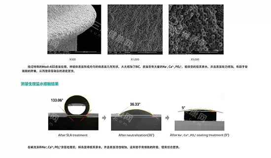 冠心病能種植牙嗎？心臟病患者種牙指南，可靠性和術前評估全知道