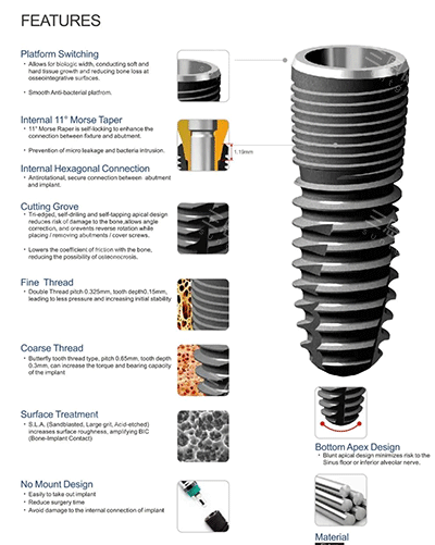 深圳启正口腔无论系基础种植定系复杂种植，都有相当高嘅水准同可靠度！
