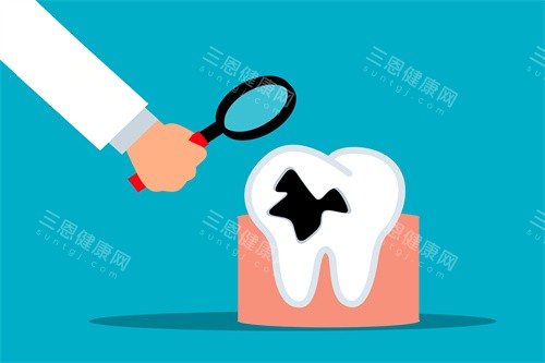 牙齿检查展示图示 牙齿检查展示图示