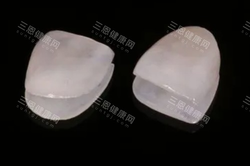 牙贴面材料卡通图 牙贴面材料卡通图