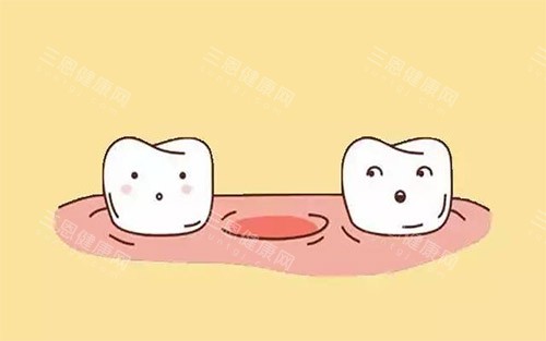 老年人牙齒脱落怎麼辦？有條件的可做種牙、活動義齒及吸附性義齒來改善