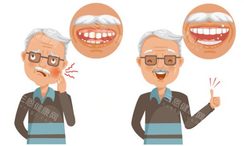 老人缺牙示意图 老人缺牙示意图