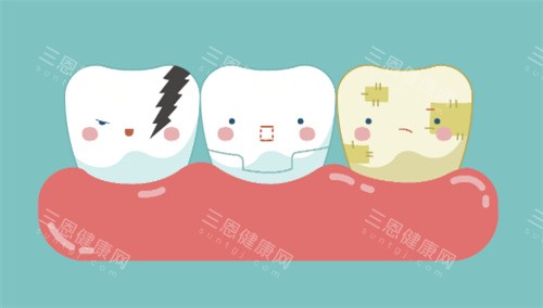 牙齿美白对比卡通图 牙齿美白对比卡通图