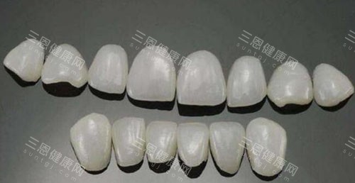 瓷贴面修复改善 瓷贴面修复改善