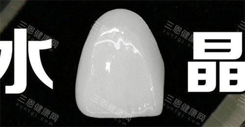 水晶瓷贴面 水晶瓷贴面