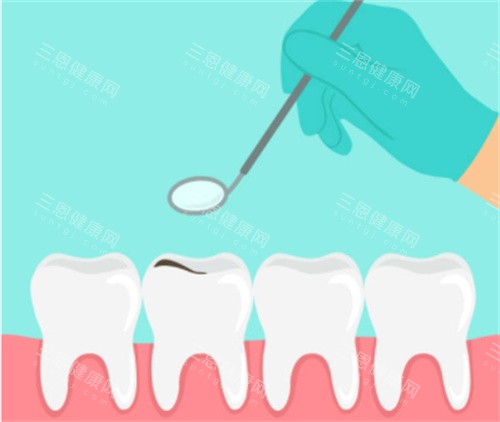 牙齿检查卡通图片