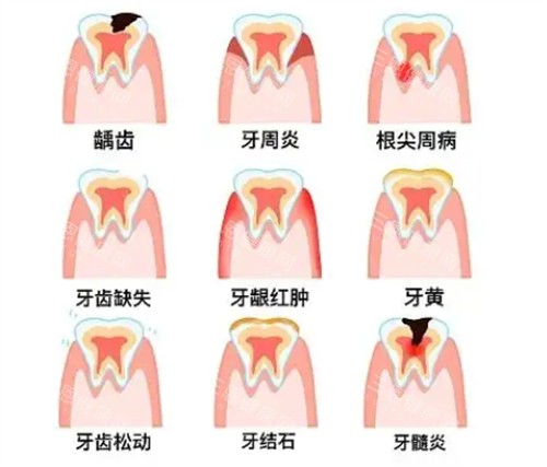 不同牙齿问题