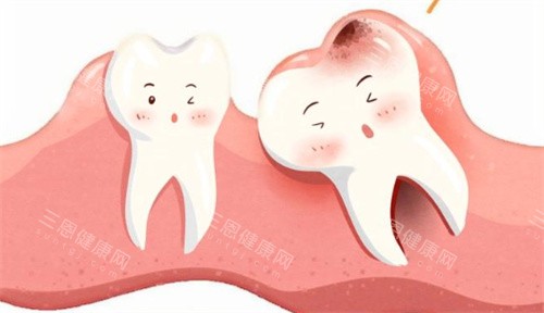 深圳拔智齒邊間好？以下10家是深圳拔智齒技術服務好的牙科醫院