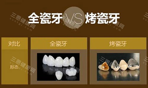 烤瓷牙和全瓷牙对比展示图