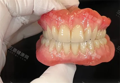 成品吸附性义齿