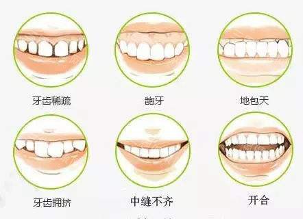 牙齿矫正不同的适应症