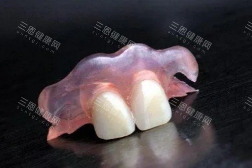 活动义齿卡通图