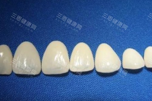 烤瓷牙冠卡通展示图