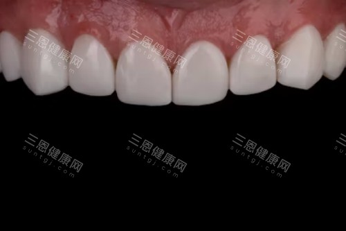 牙齿护理宣传图 牙齿护理宣传图