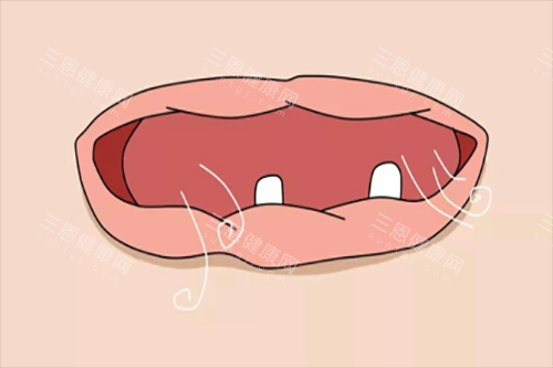 深圳維港口腔點解咁受港人歡迎？正規技術+透明價格+粵語服務成「北上睇牙」熱選！