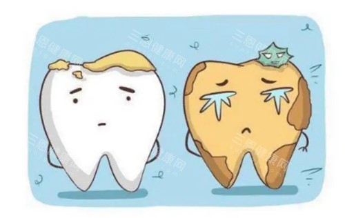 需要清洁的牙齿卡通示意图 需要清洁的牙齿卡通示意图