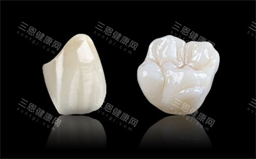 格莱美全瓷