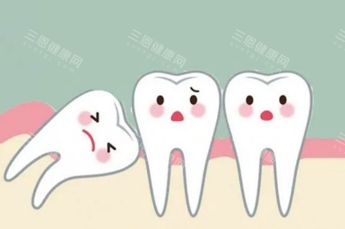 智齿图片一览