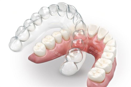深圳博愛曙光醫院矯正牙齒點樣呀？美國隱適美/時代天使雙認證！博愛曙光口腔正畸好又實惠！