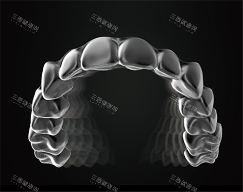 美立刻隐形牙套图示