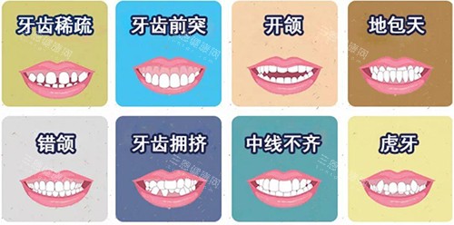 牙齿矫正不同适应症漫画图