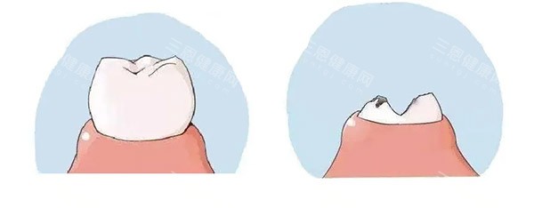 2025深圳弘傑口腔價目表：全口塗氟190元起、種植牙3200元起、矯正5499元起享