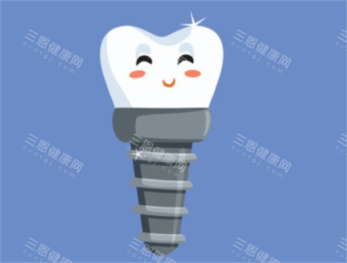 健康种植牙卡通图