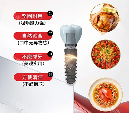 深圳寶城口腔醫院做種植牙好不好？種牙技術水平高不高呢？