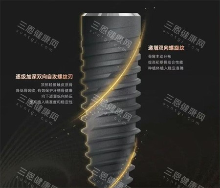 卡尔斯种植牙种植体螺纹照片 卡尔斯种植牙种植体螺纹照片