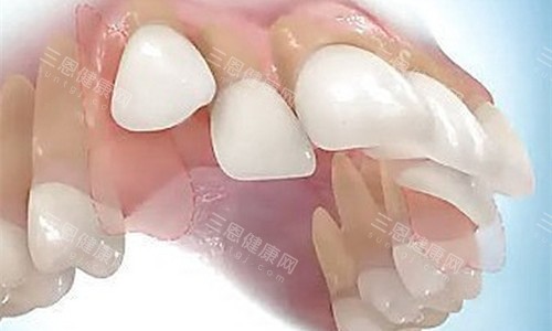 深圳金牙福口腔看牙怎麽樣？龍崗區高人氣齒科|醫生技術強|口碑爆棚