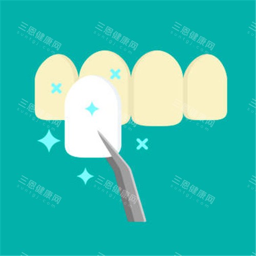 牙齿贴面图 牙齿贴面图