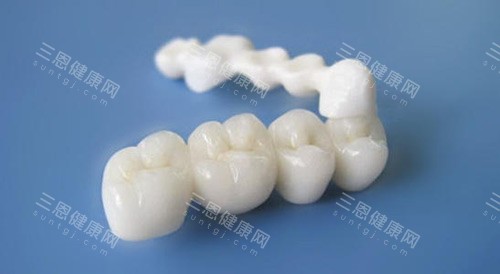 愛爾創二氧化鋯全瓷牙價格表!有不同的系列產品，其性能和質量可能會有所差異