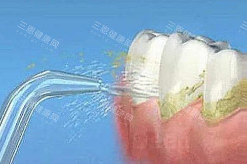洗牙卡通图片展示 洗牙卡通图片展示