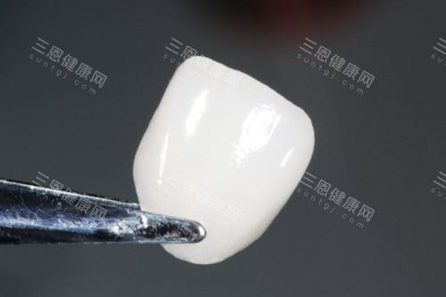 牙贴面材料展示图 牙贴面材料展示图