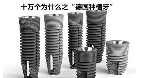深圳正規醫院種一顆牙要多少錢？2025年深圳種植牙價格全解析